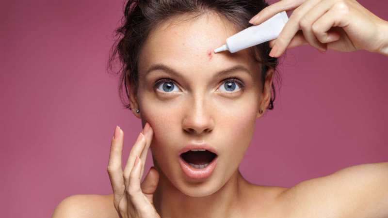 Acne And The Best Treatment The Market Offers