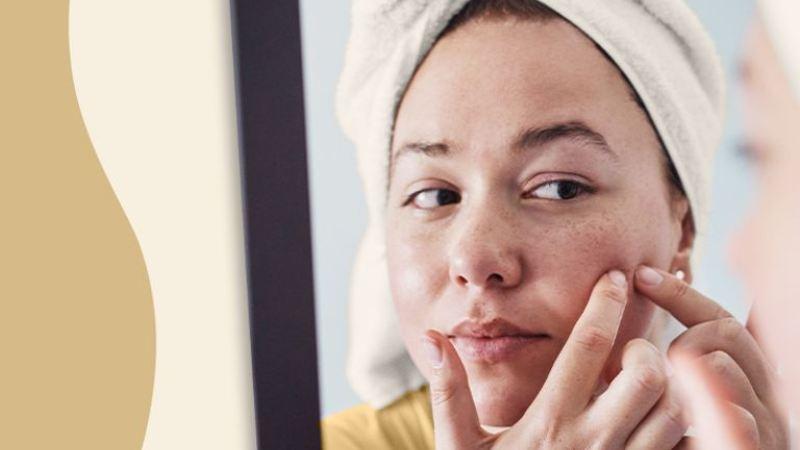 The Top 10 Solutions For Herbal Acne Treatment