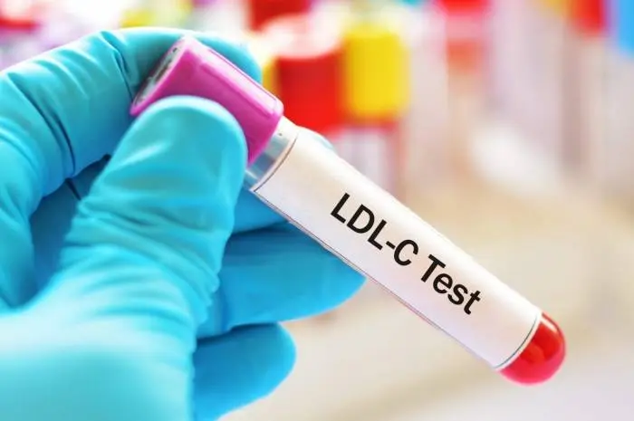 LDL Cholesterol: Understanding Normal Range, Implications, and Management